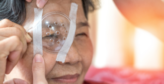 Woman receiving care for cataracts stock image